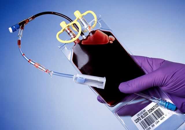 Cena pupenkové krve - vše, co potřebujete vědět