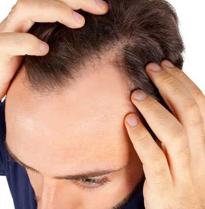 Bolest pokožky hlavy: příčiny, symptomy a léčba | Návod a tipy