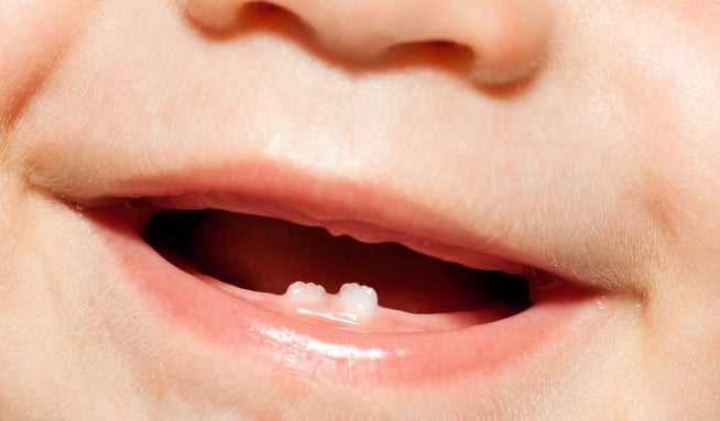 Horečka při růstu zubů: Příčiny, symptomy a léčba