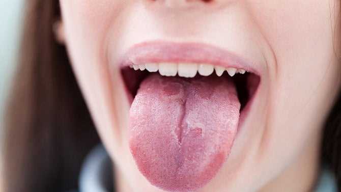 Pocit spáleného jazyka příčiny příznaky a léčba