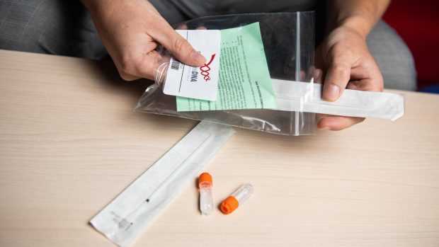 Alzheimerův test: Jak na něj a jaké jsou výsledky