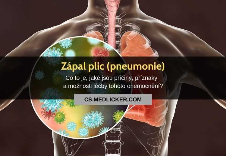 Antibiotika na zápal plic: Vše, co potřebujete vědět Antibiotika na zápal plic: Vše, co potřebujete vědět