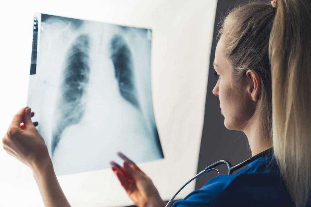 Antibiotika na zápal plic: Vše, co potřebujete vědět Antibiotika na zápal plic: Vše, co potřebujete vědět