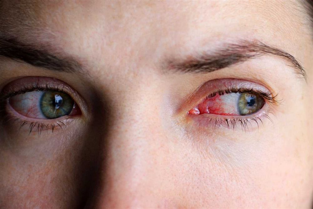 Černá tečka v oku příčiny, symptomy a léčba