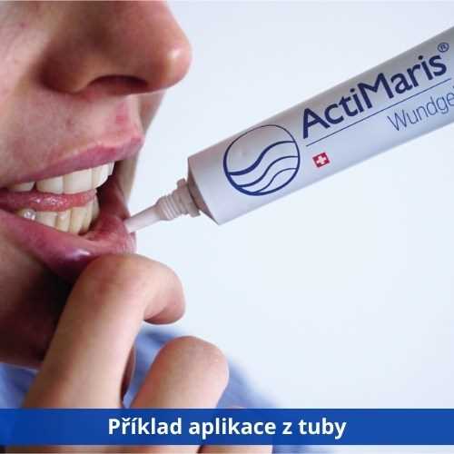 Mast na červený nos - účinný lék na zarudlou pokožku Mast na červený nos - účinný lék na zarudlou pokožku