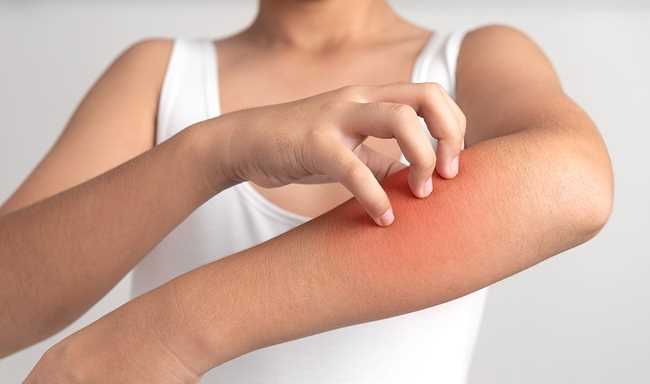 Jak se přirozeně zbavit alergie: efektivní metody a tipy Jak se přirozeně zbavit alergie: efektivní metody a tipy