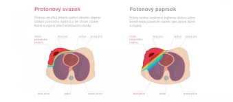 Nejvhodnější způsoby léčby rakoviny | Návod a doporučení Nejvhodnější způsoby léčby rakoviny | Návod a doporučení