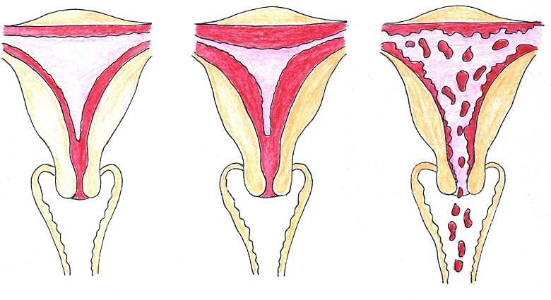 Nevolnost před menstruací: Příčiny, symptomy a léčba