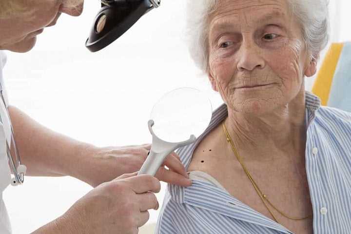 Rakovina dává děsivé příznaky: Jak je rozpoznat včas
