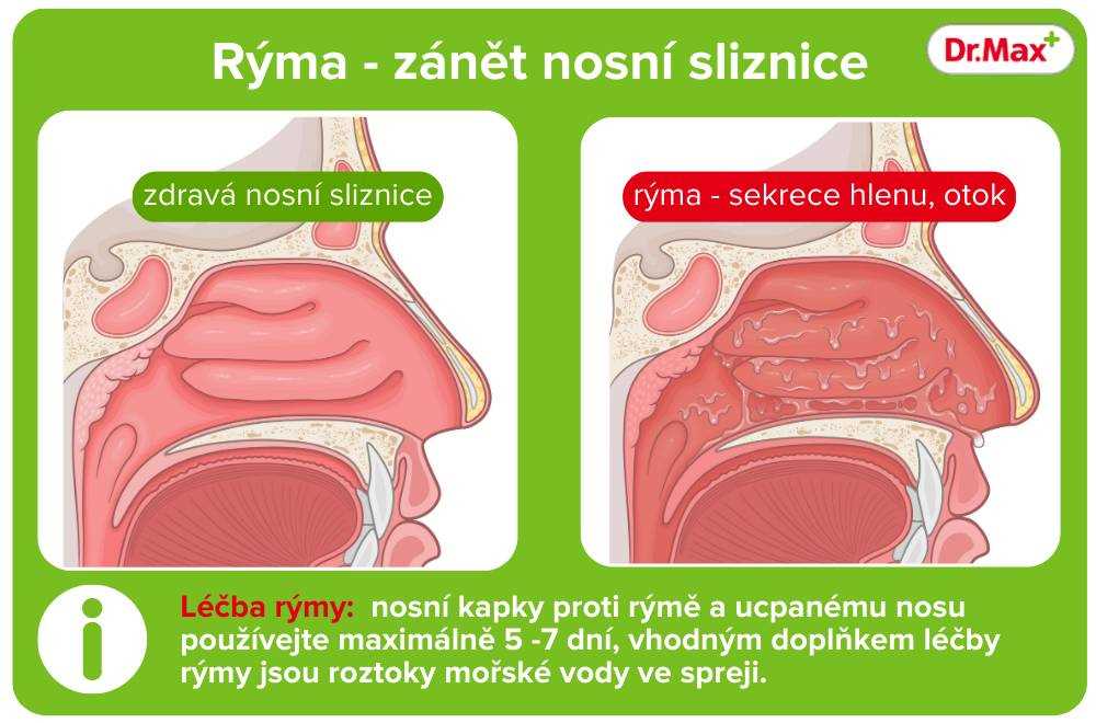 Rýma v očích - příznaky, příčiny a léčba | Návody a tipy