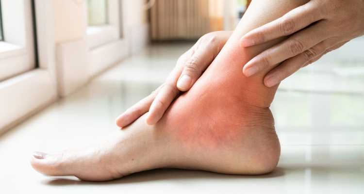Oteklé kotníky a rty - příčiny, symptomy a léčba Oteklé kotníky a rty - příčiny, symptomy a léčba