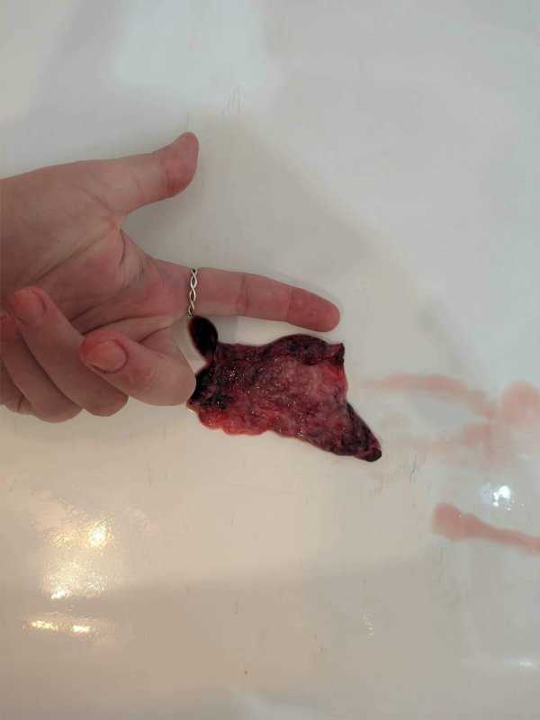 Velmi slabá menstruace: příčiny, příznaky a léčba | Náš web Velmi slabá menstruace: příčiny, příznaky a léčba | Náš web