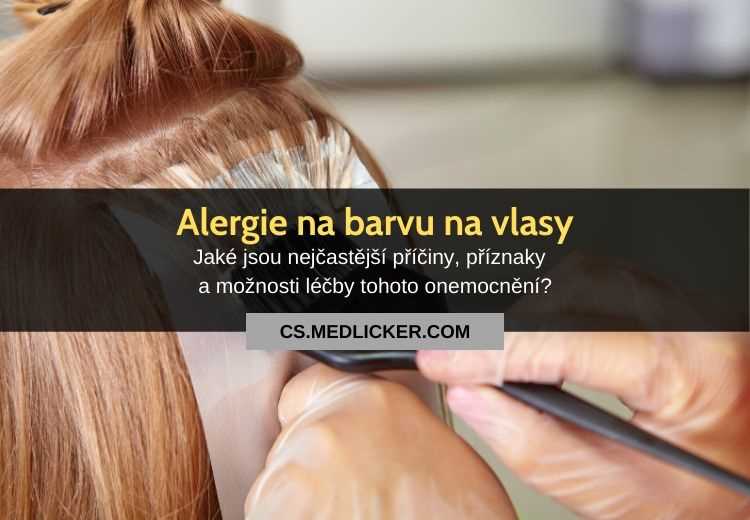 Alergie na barvu na vlasy: Příčiny, příznaky a léčba
