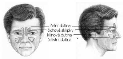 Kronický zánět dutin: příznaky, příčiny a léčba