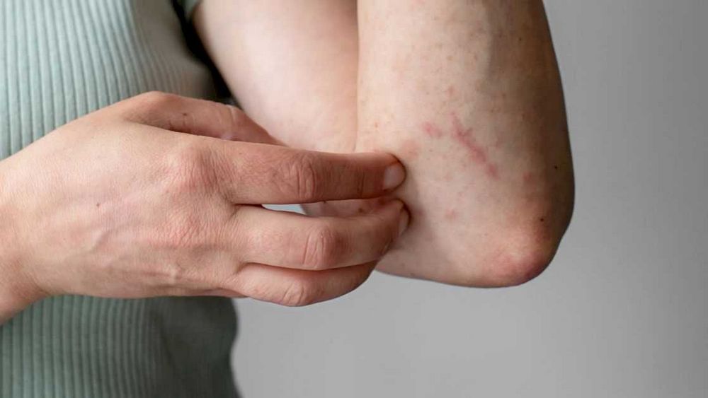Puchýře v krku - příčiny, příznaky a léčba | Návod a rady Puchýře v krku - příčiny, příznaky a léčba | Návod a rady