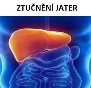 Steatoza jater: Jak správně jíst pro zdravá játra